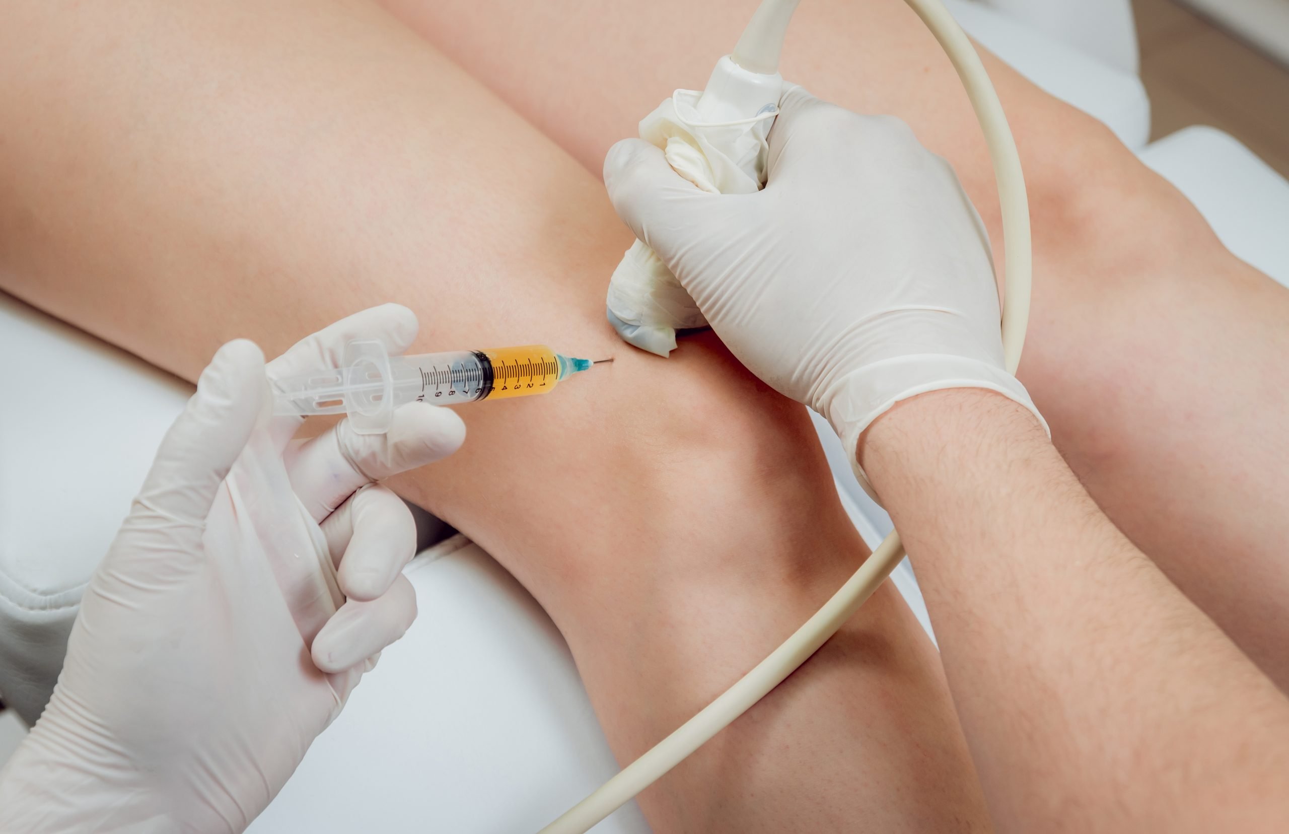 prolotherapy